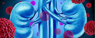 healthy natural foods to improve kidney