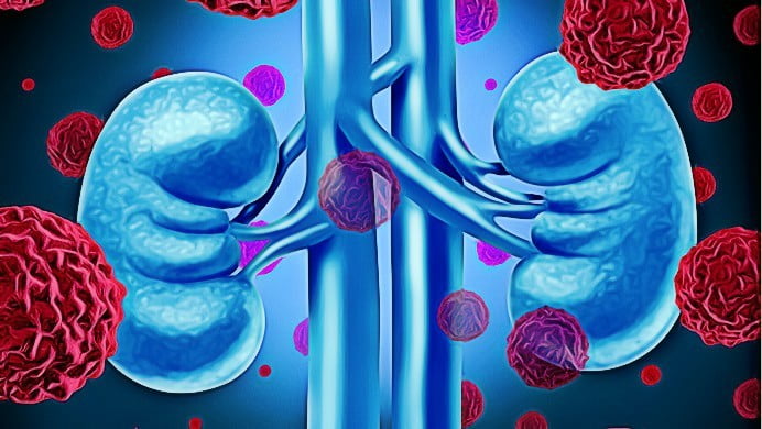 healthy natural foods to improve kidney
