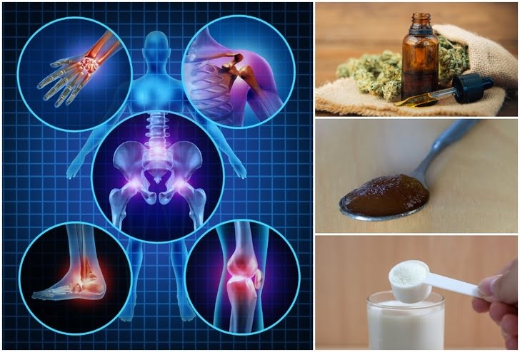 arthritis remedies
