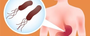helicobacter pylori simptome cauze