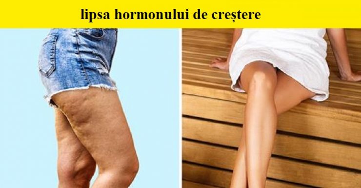 hormoni imbatranire