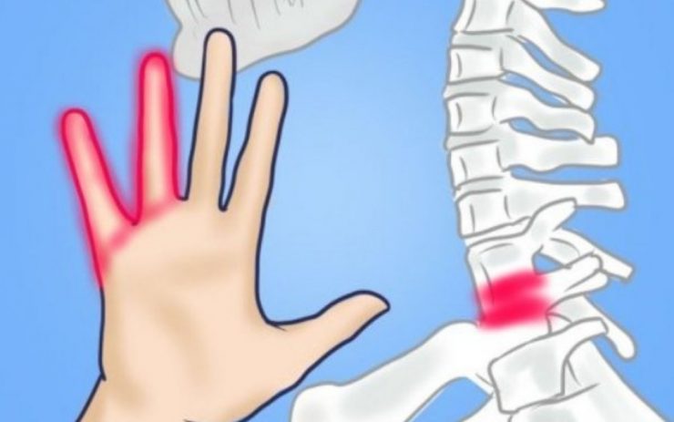 osteochondroza coloanei vertebrale și durere în articulația șoldului