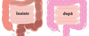 colon toxine