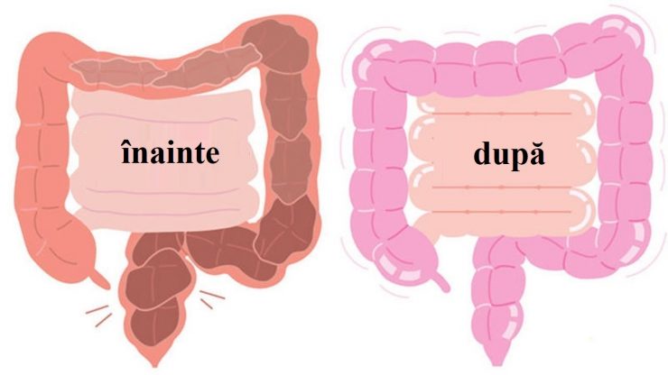colon toxine