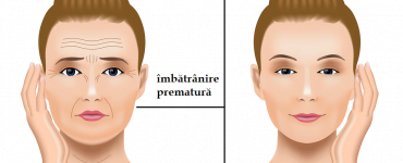 imbatranire rapida