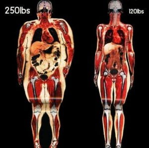 poze kilograme