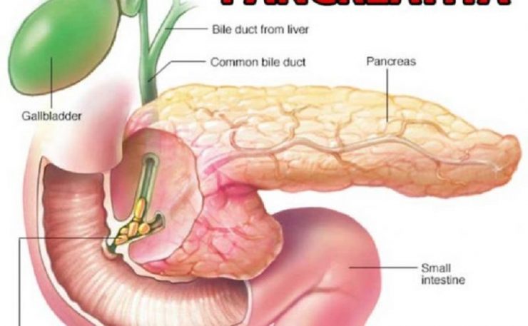 pancreas simptome