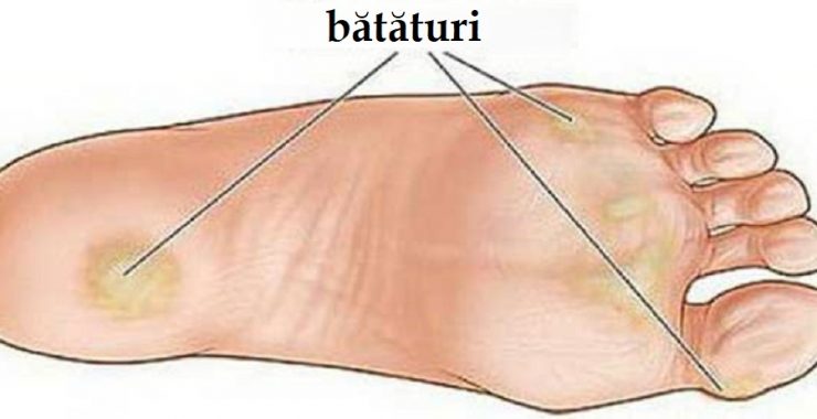 reteta bataturi