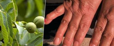 nuci remedii
