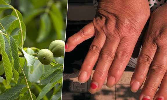 nuci remedii