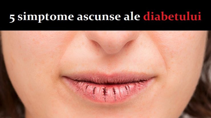 diabet ascuns