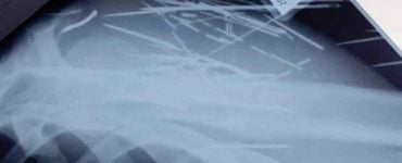 Medic din Botoşani îngrozit după ce a făcut o radiografie unui pacient 696x418
