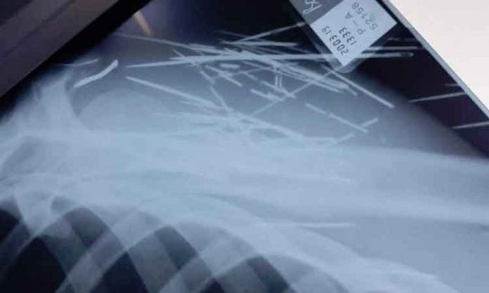 Medic din Botoşani îngrozit după ce a făcut o radiografie unui pacient
