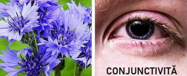 remedii conjunctivita