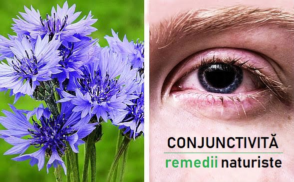 remedii conjunctivita