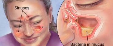 sinuses