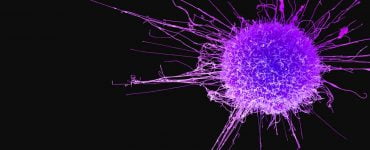 c0462719 cervical cancer cell sem spl