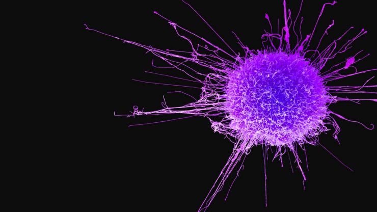 c0462719 cervical cancer cell sem spl