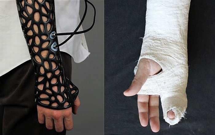 osteoid gips 3 d