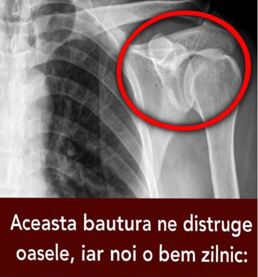 descărcare 4