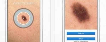 skin vision 600x330