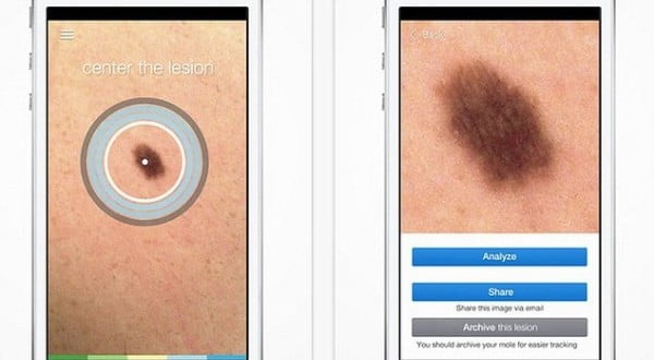 skin vision