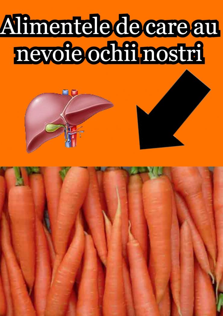100 4