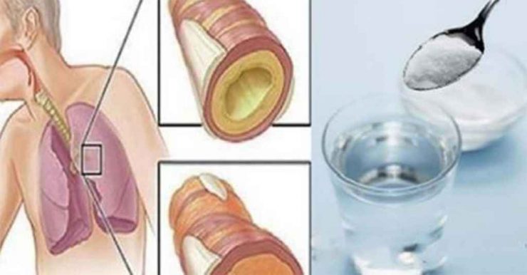 bicarbonat apa 1024x534