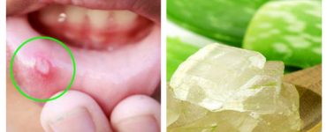 aloe vera 1