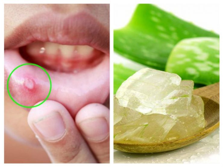 aloe vera 1