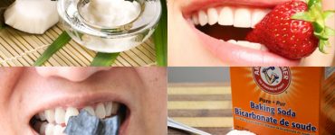 bicarb soda teeth