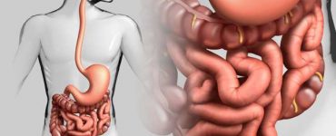 intestinele
