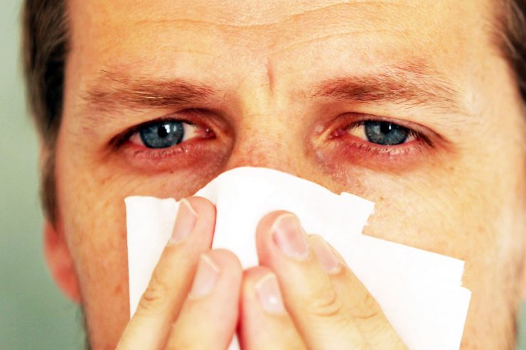 red eyes coronavirus 13