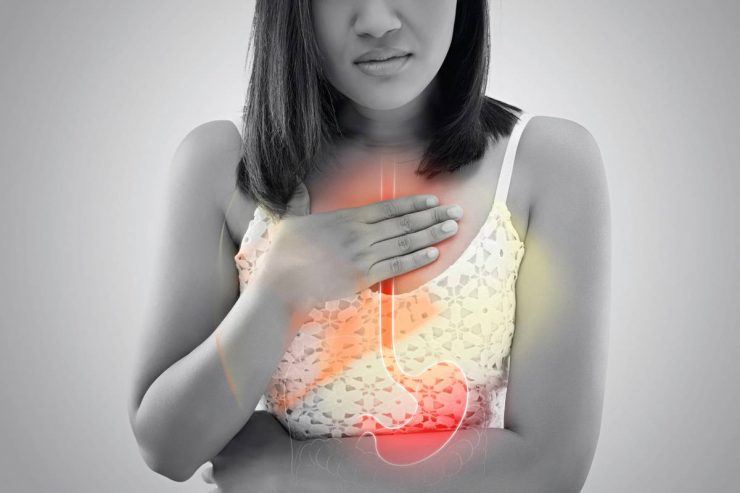 reflux