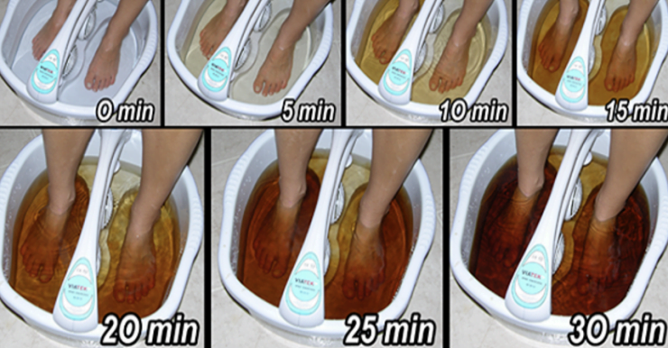 detox picioare 740x386 1