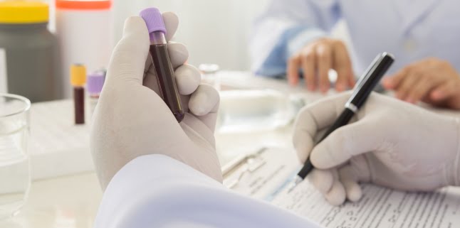 analize sange investigatii