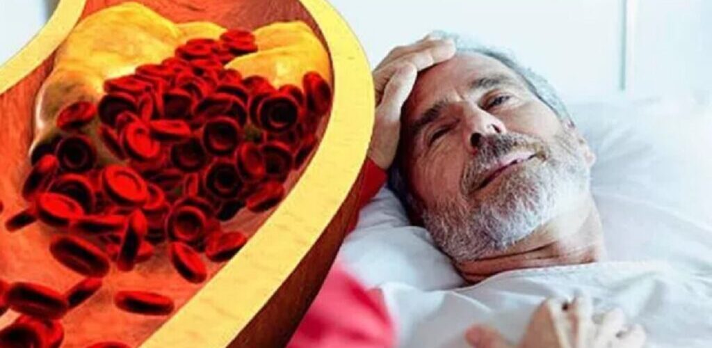 colesterol ridicat 1024x604 1