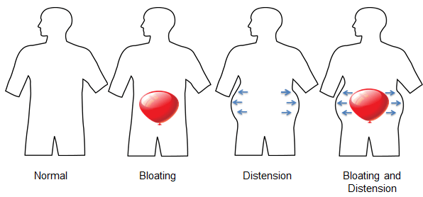 Aceasta bacterie provoaca balonare si te impiedica sa slabesti
