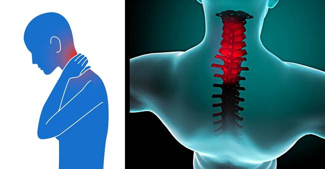 Health Tips How to Relieve Stiff Neck Naturally in 90 Seconds