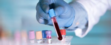 Hands,Of,A,Lab,Technician,With,A,Tube,Of,Blood