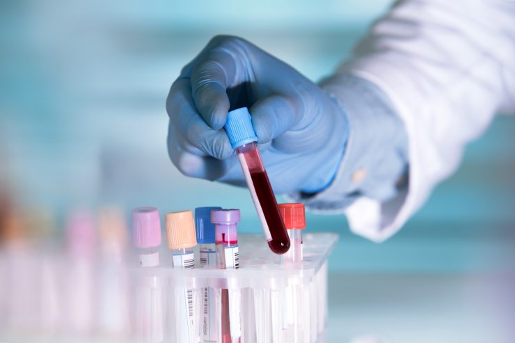 Hands,Of,A,Lab,Technician,With,A,Tube,Of,Blood