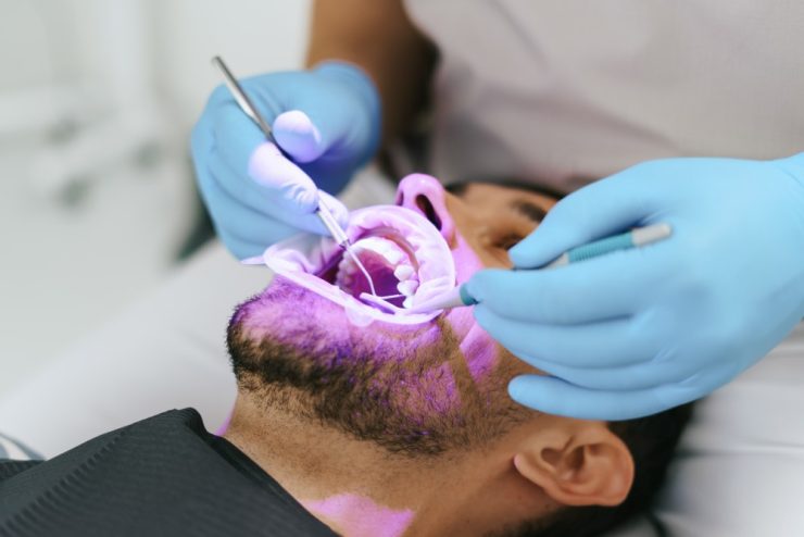 Procesul de realizare a unei coroane dentare la Alegra Dental Office