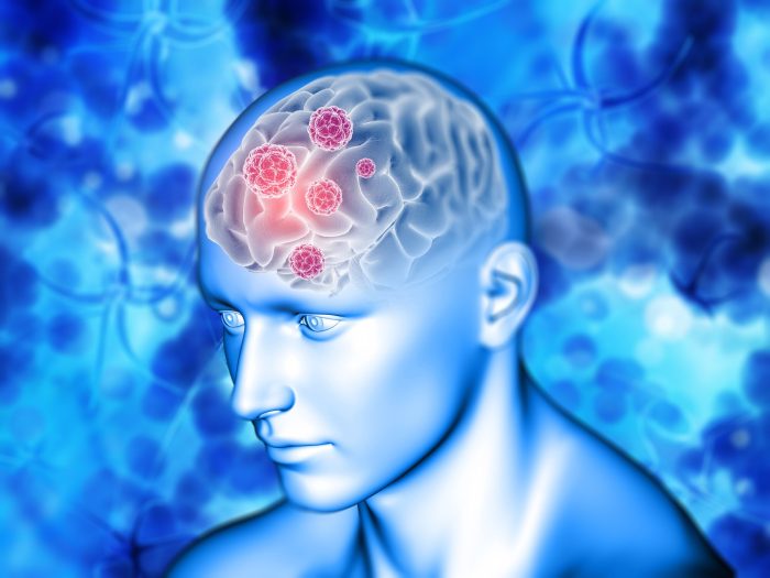 3d medical background with brain highlighted 1048 10407 1 700x525 1
