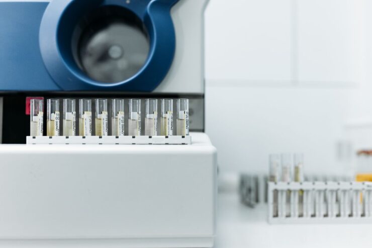 Porfobilinogen: ce arată analiza și când e recomandată?