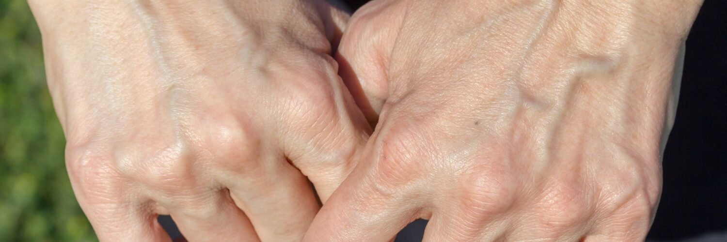 HandVeins