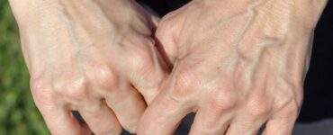 HandVeins