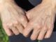 HandVeins